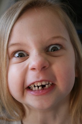 Girl with Missing Tooth